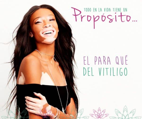 El Vitiligo